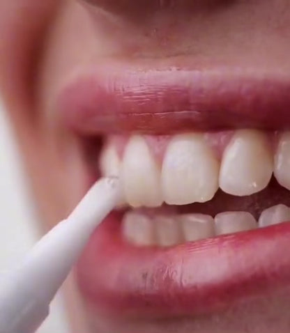 Dentafixer Teeth Whitening Pen